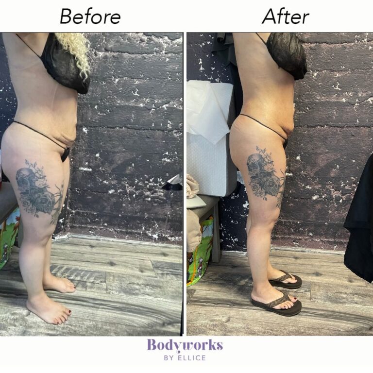 Bodyworks Before & After Phogos-min